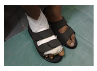 orthopedic diabetic shoes
