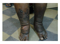 orthopedic footwear