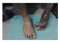 orthopedic diabetic shoes