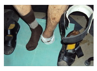 orthopedic diabetic shoes