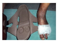 orthopedic diabetic shoes