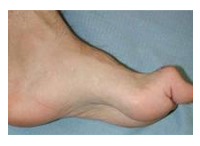 orthopedic diabetic shoes
