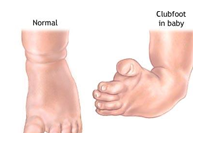 orthopedic diabetic shoes