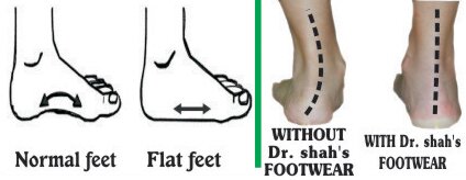 diabetic shoes